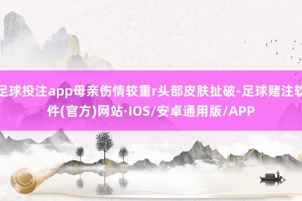 足球投注app母亲伤情较重r头部皮肤扯破-足球赌注软件(官方)网站·IOS/安卓通用版/APP
